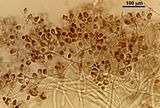 6 - Cellule corticali dissociate e filamenti midollari